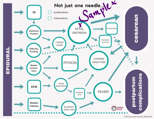 InkedNot just one needle... - Copy_LI risks of epidural flow chart
