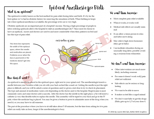 epidural-side1-sample epidural risks benefits fact sheet