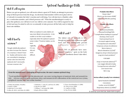 epidural-side2-sample epidural fact sheet, risks epidural, handout research