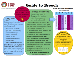 breech guide